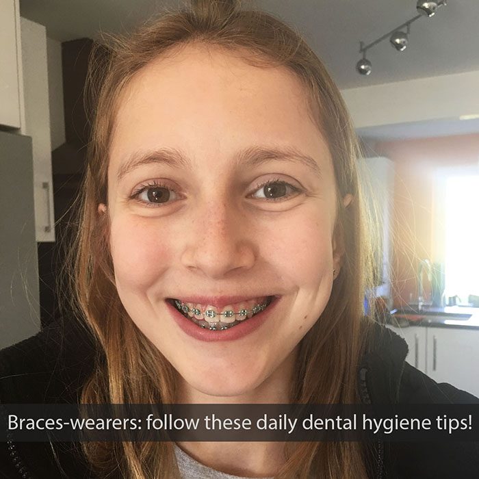 daily-braces-care-2021_700.jpg