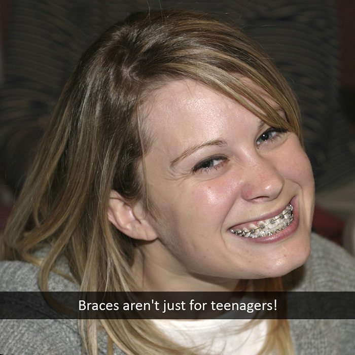 adult-braces-2022_700.jpg